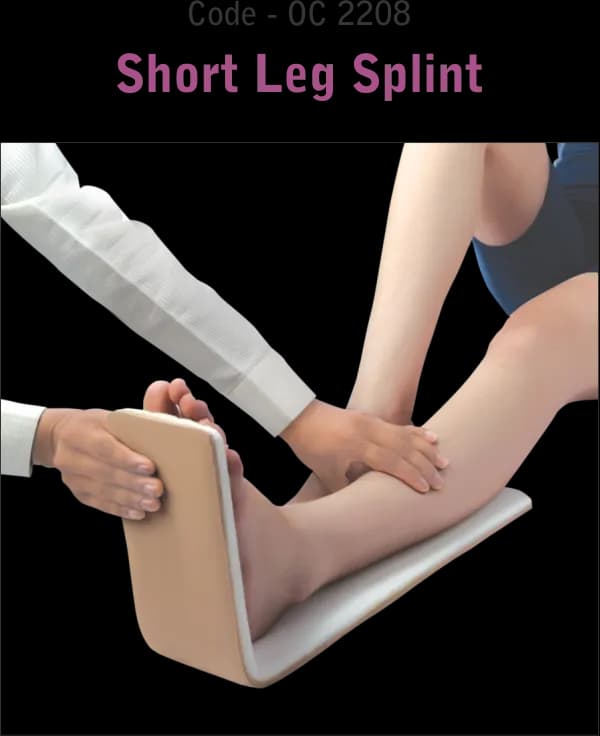 Short Leg Splint